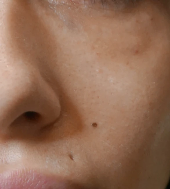 after-mauroi-kykloi-01