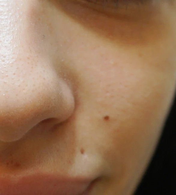 before-mauroi-kykloi-01