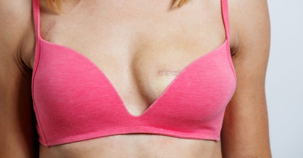 Paramedical Tattoo: Medical Restoration with Aesthetic Precision