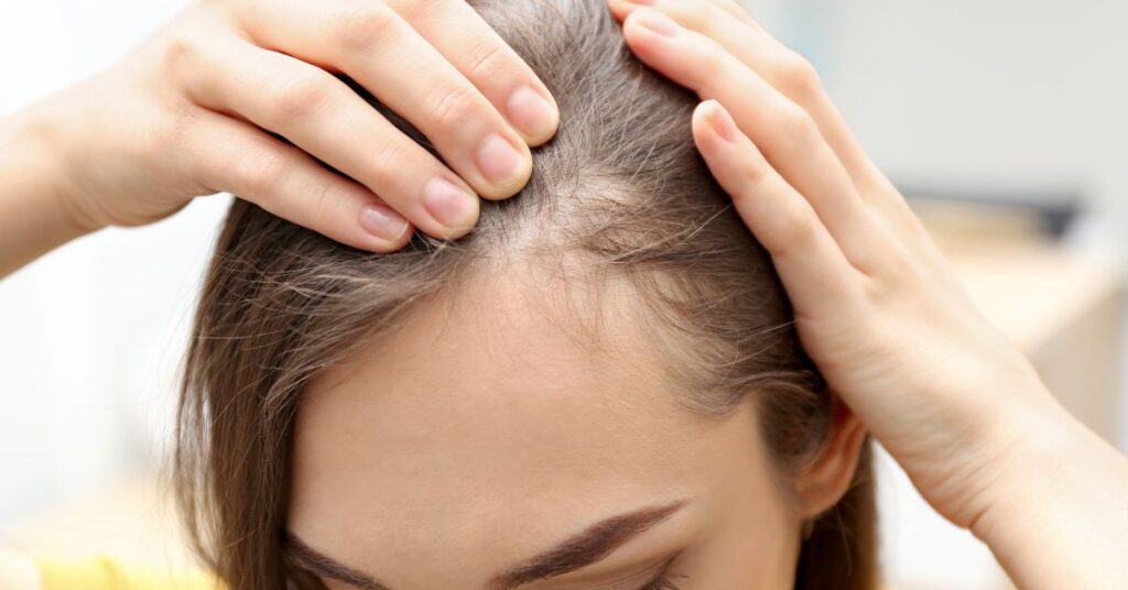 Hair Loss: A Multifactorial Condition Requiring Personalized Medical Strategy